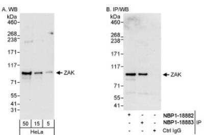 Western Blot: ZAK Antibody [NBP1-18882]