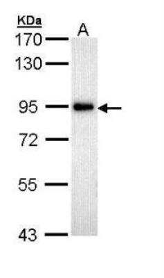 Western Blot: ZAK Antibody [NBP1-33137]