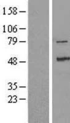 Western Blot: ZAK Overexpression Lysate [NBL1-17956]