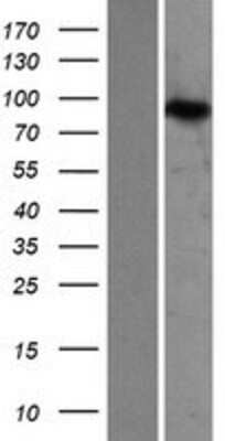 Western Blot: ZAK Overexpression Lysate [NBP2-07004]