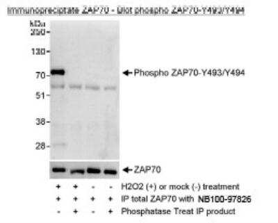 Immunoprecipitation: ZAP70 [p Tyr494] Antibody [NBP1-18898]