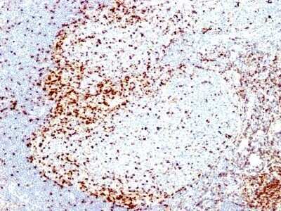 Immunohistochemistry-Paraffin: ZAP70 Antibody (2F3.2) - Azide and BSA Free [NBP2-47774]