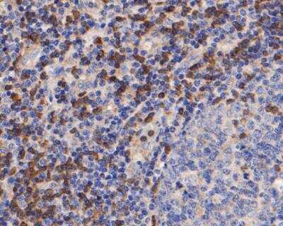 Immunohistochemistry-Paraffin: ZAP70 Antibody (A1B5) [NBP2-89121]