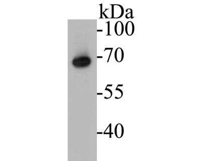 Western Blot: ZAP70 Antibody (A1B5) [NBP2-89121]