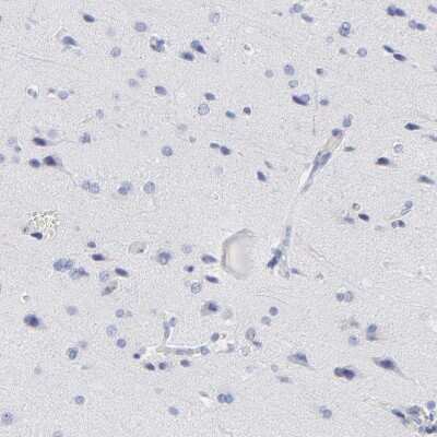 Immunohistochemistry-Paraffin: ZAP70 Antibody [NBP1-87000]
