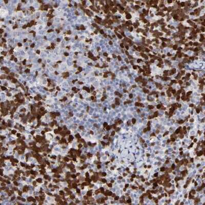 Immunohistochemistry-Paraffin: ZAP70 Antibody [NBP1-87000]