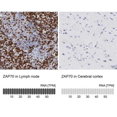Immunohistochemistry-Paraffin: ZAP70 Antibody [NBP1-87000]