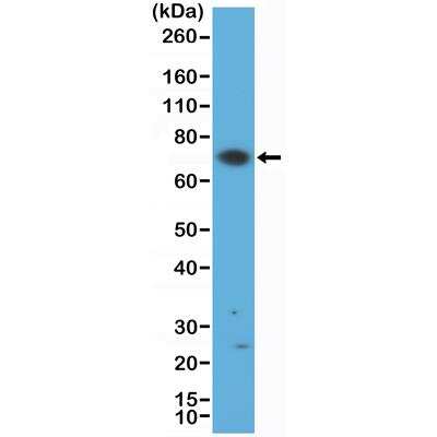 Western Blot: ZAP70 Antibody (RM408) [NBP2-89104]