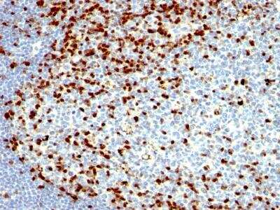 Immunohistochemistry-Paraffin: ZAP70 Antibody (SPM362) - IHC-Prediluted [NBP2-48250]