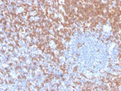Immunohistochemistry-Paraffin: ZAP70 Antibody (ZAP70/4040R) - Azide and BSA Free [NBP3-08968]