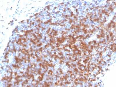 Immunohistochemistry-Paraffin: ZAP70 Antibody (ZAP70/4040R) - Azide and BSA Free [NBP3-08968]