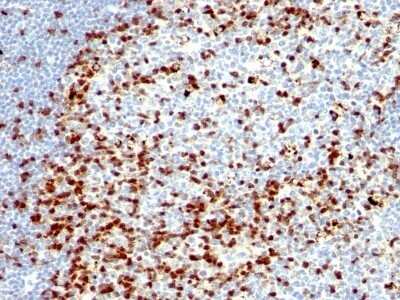 Immunohistochemistry-Paraffin: ZAP70 Antibody (ZAP70/528 + 2F3.2) - Azide and BSA Free [NBP2-47775]