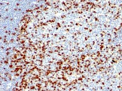 Immunohistochemistry-Paraffin: ZAP70 Antibody (ZAP70/528 + 2F3.2) - IHC-Prediluted [NBP2-48272]