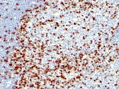 Immunohistochemistry-Paraffin: ZAP70 Antibody (ZAP70/528 + 2F3.2) [NBP2-44505]