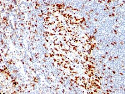 Immunohistochemistry-Paraffin: ZAP70 Antibody (ZAP70/528) - IHC-Prediluted [NBP2-48251]