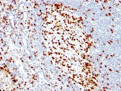 Immunohistochemistry-Paraffin: ZAP70 Antibody (ZAP70/528) [NBP2-44504]