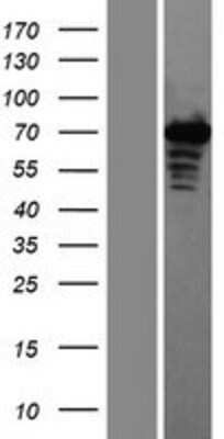 Western Blot: ZAP70 Overexpression Lysate [NBP2-08469]