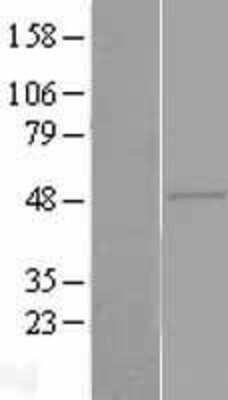 Western Blot: ZAR1 Overexpression Lysate [NBL1-17958]