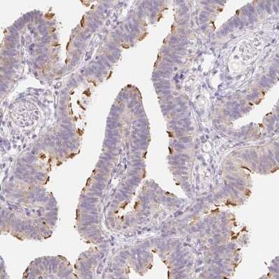 Immunohistochemistry: ZBBX Antibody [NBP2-38294]