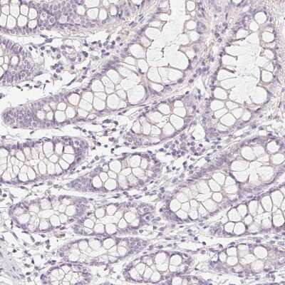 Immunohistochemistry-Paraffin: ZBBX Antibody [NBP1-82092]