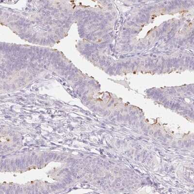 Immunohistochemistry-Paraffin: ZBBX Antibody [NBP1-82092]
