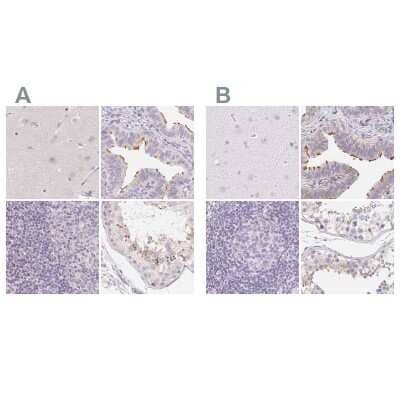 Immunohistochemistry-Paraffin: ZBBX Antibody [NBP1-82092]