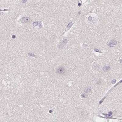 Immunohistochemistry-Paraffin: ZBBX Antibody [NBP1-82092]