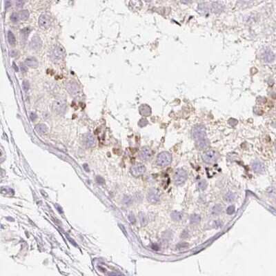 Immunohistochemistry-Paraffin: ZBBX Antibody [NBP1-82092]