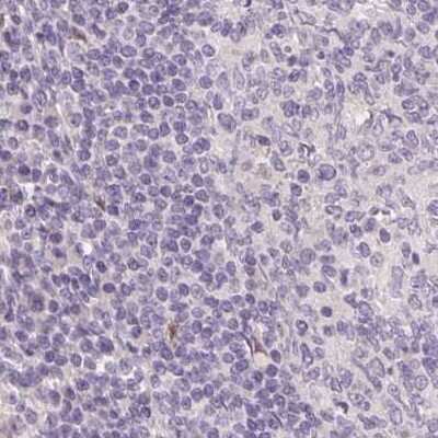 Immunohistochemistry-Paraffin: ZBBX Antibody [NBP1-82092]