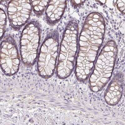 Immunohistochemistry-Paraffin: ZBBX Antibody [NBP2-38294]