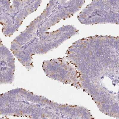 Immunohistochemistry-Paraffin: ZBBX Antibody [NBP2-38294]