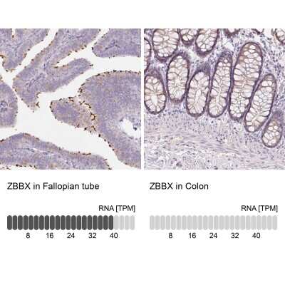 Immunohistochemistry-Paraffin: ZBBX Antibody [NBP2-38294]