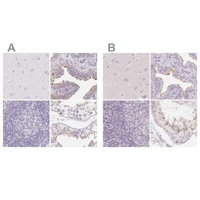 Immunohistochemistry-Paraffin: ZBBX Antibody [NBP2-38294]