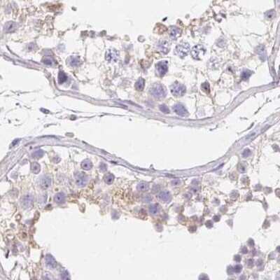 Immunohistochemistry-Paraffin: ZBBX Antibody [NBP2-38294]