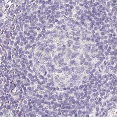 Immunohistochemistry-Paraffin: ZBBX Antibody [NBP2-38294]