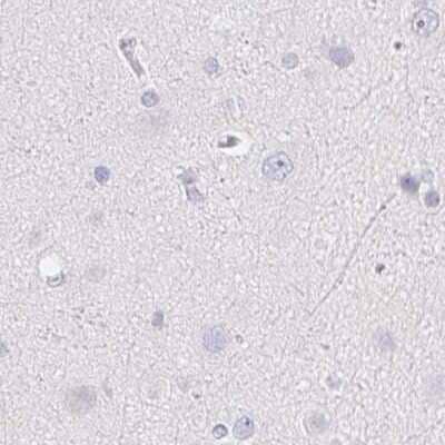 Immunohistochemistry-Paraffin: ZBBX Antibody [NBP2-38294]