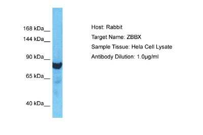 Western Blot: ZBBX Antibody [NBP2-86399]