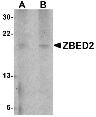 Western Blot: ZBED2 AntibodyBSA Free [NBP1-77349]