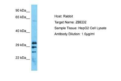 Western Blot: ZBED2 Antibody [NBP2-86899]