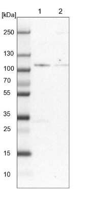 Western Blot: ZBED4 Antibody [NBP2-13531]