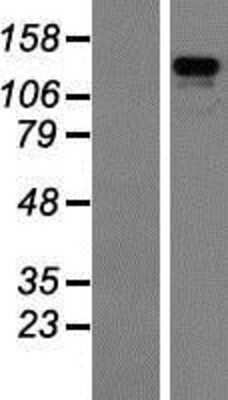 Western Blot: ZBED4 Overexpression Lysate [NBP2-07265]