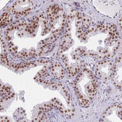 Immunohistochemistry-Paraffin: ZBED5 Antibody [NBP2-13532]