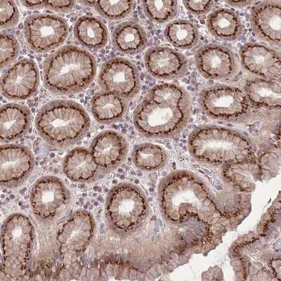 Immunohistochemistry-Paraffin: ZBED5 Antibody [NBP2-13533]