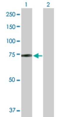 Western Blot: ZBED5 Antibody [H00058486-B01P]