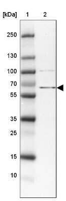 Western Blot: ZBED5 Antibody [NBP2-13533]