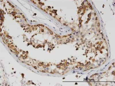 Immunohistochemistry-Paraffin: ZBP1/DLM-1/DAI Antibody (2C10) [H00081030-M01]