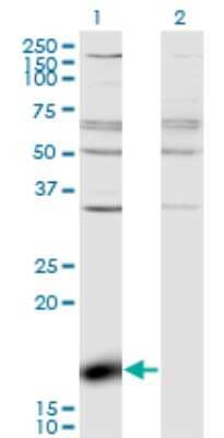 Western Blot: ZBP1/DLM-1/DAI Antibody (2C10) [H00081030-M01]