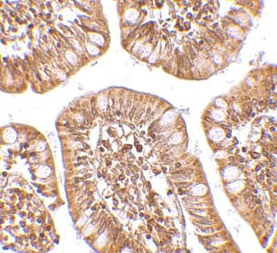 Immunohistochemistry-Paraffin: ZBP1/DLM-1/DAI Antibody - BSA Free [NBP1-76854]