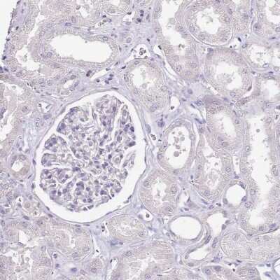 Immunohistochemistry-Paraffin: ZBP1/DLM-1/DAI Antibody [NBP2-14793]
