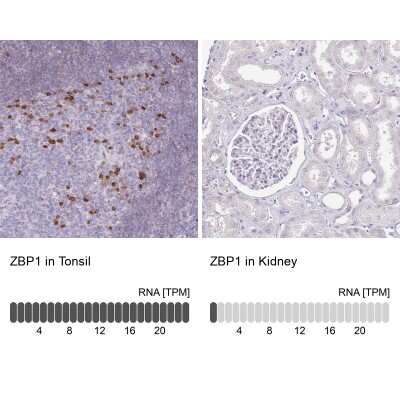 Immunohistochemistry-Paraffin: ZBP1/DLM-1/DAI Antibody [NBP2-14793]